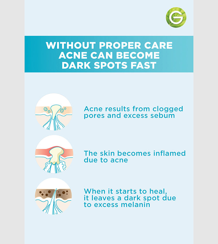 غارنييه Facial سيروم Rapid Purification فيتامين C for acne-prone skin 15 مل - الصورة 9