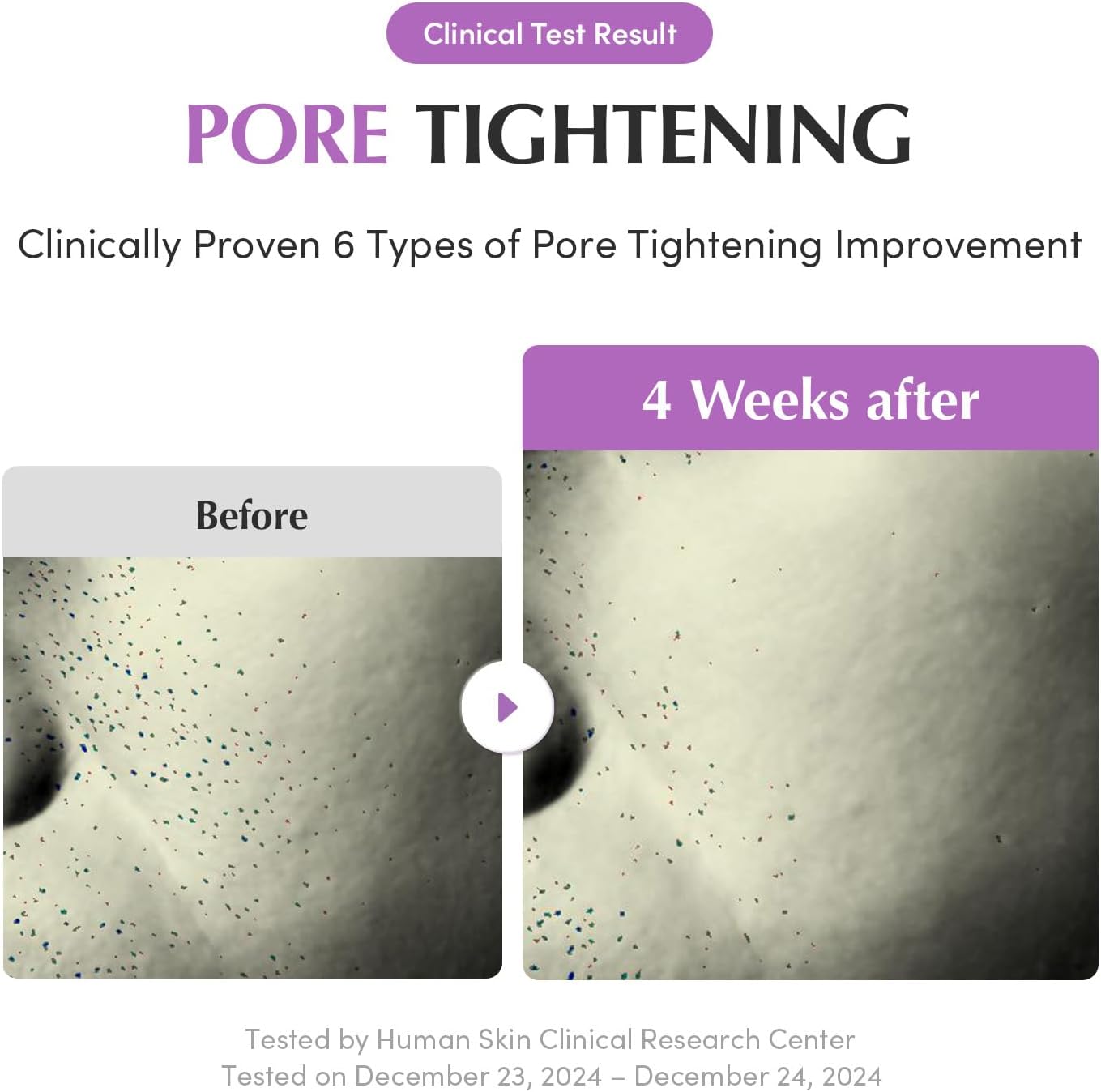 Eqqualberry Purple PDRN Pore Minimizing سيروم 30 مل - الصورة 5