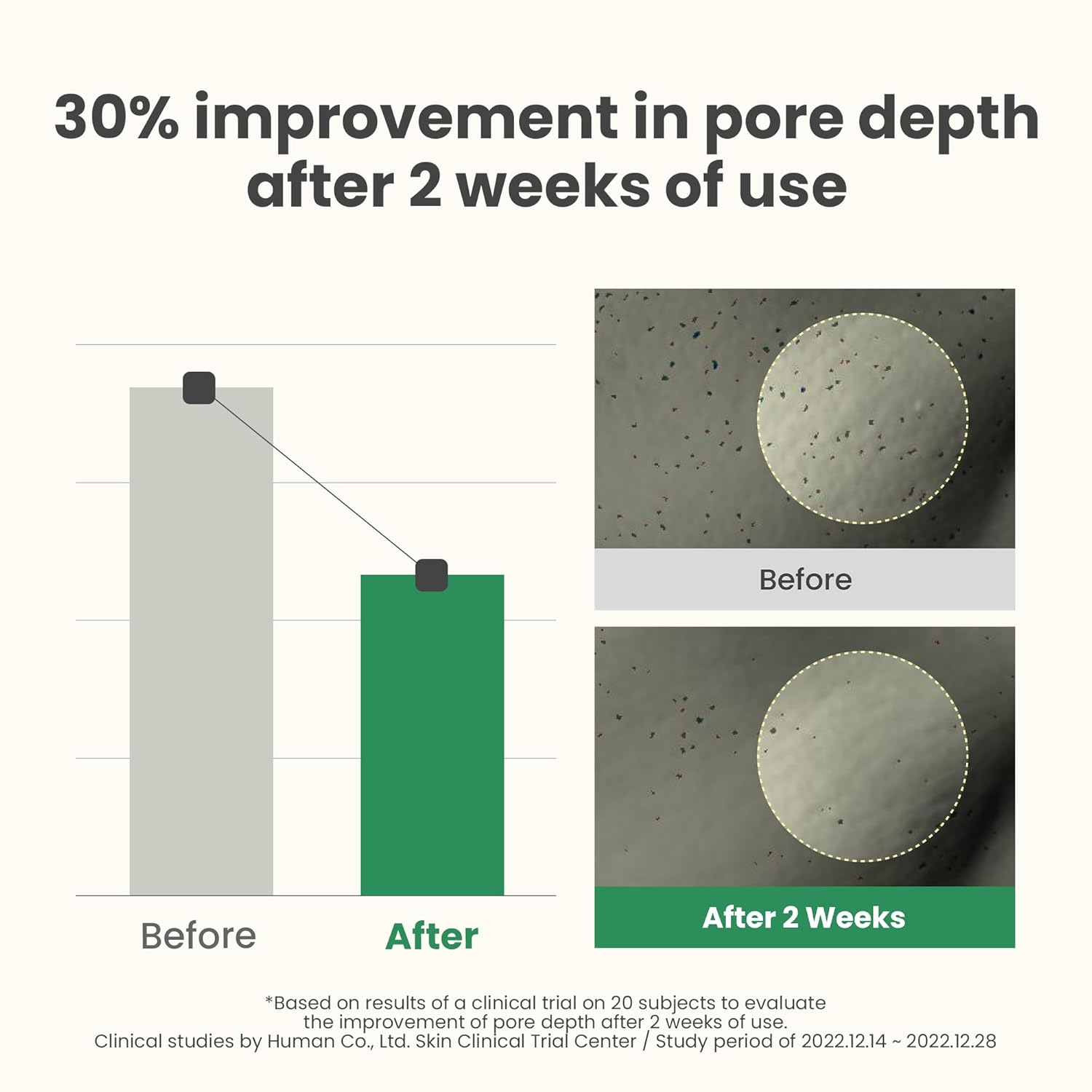 Axis-Y LHA Peel و Fill Pore Balancing كريم 50مل - الصورة 3