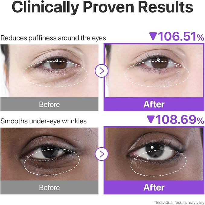 نامبوزين NMN كولاجين Under Eye Patches مع 50 Peptides - الصورة 7