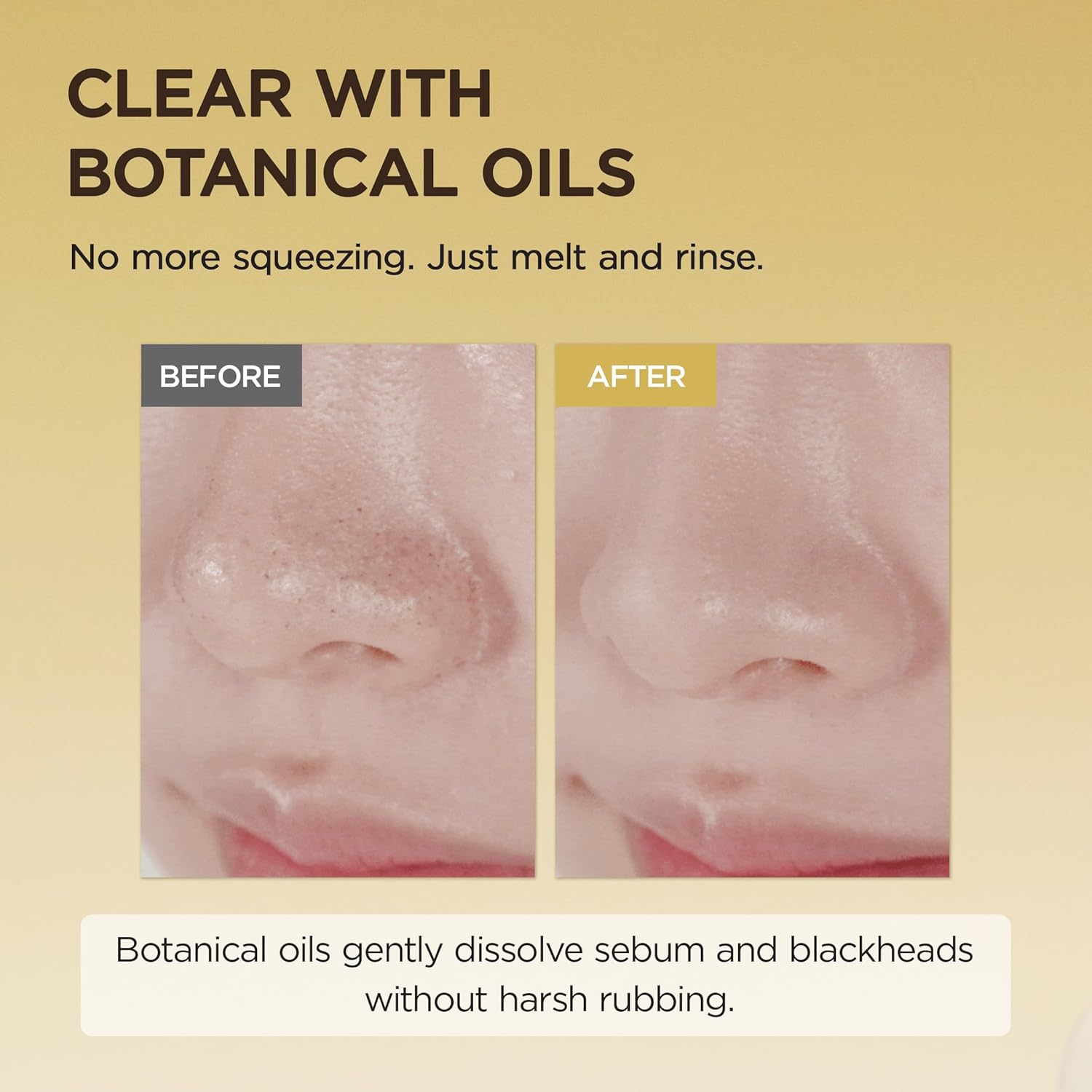SKIN1004 Madagascar Centella Light منظف زيت 200مل - الصورة 2