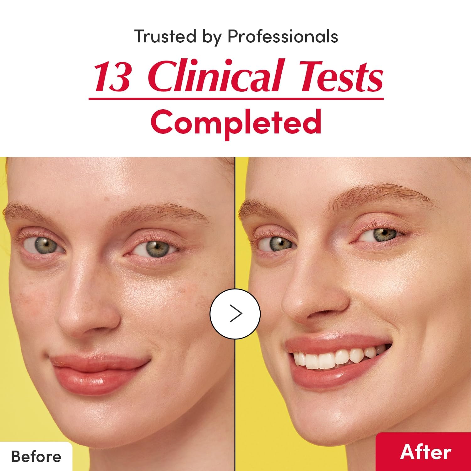 Eqqualberry Vitamin Illuminating سيروم 30مل - الصورة 4
