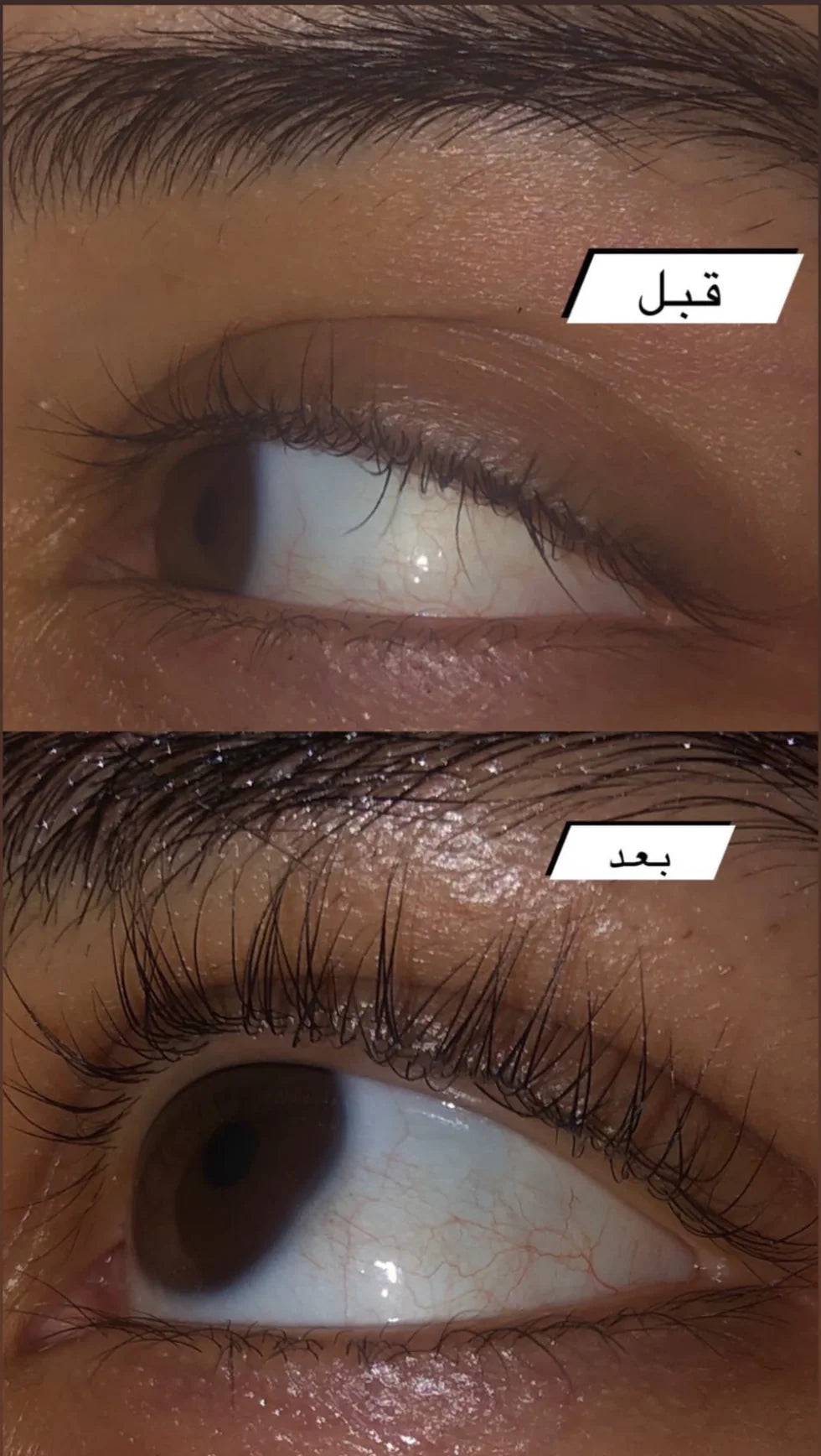 راو أفريكان Eyelash Follicle Booster جل 8 جم - الصورة 2