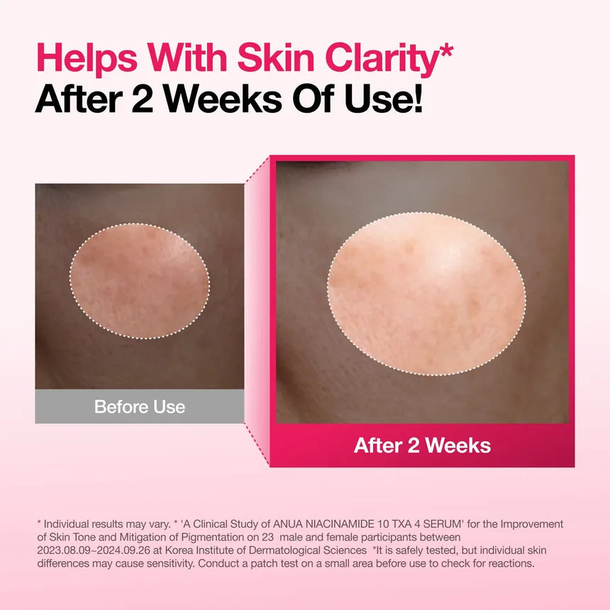 أنوا Niacinamide 10 TXA 4 سيروم 50 مل - الصورة 7