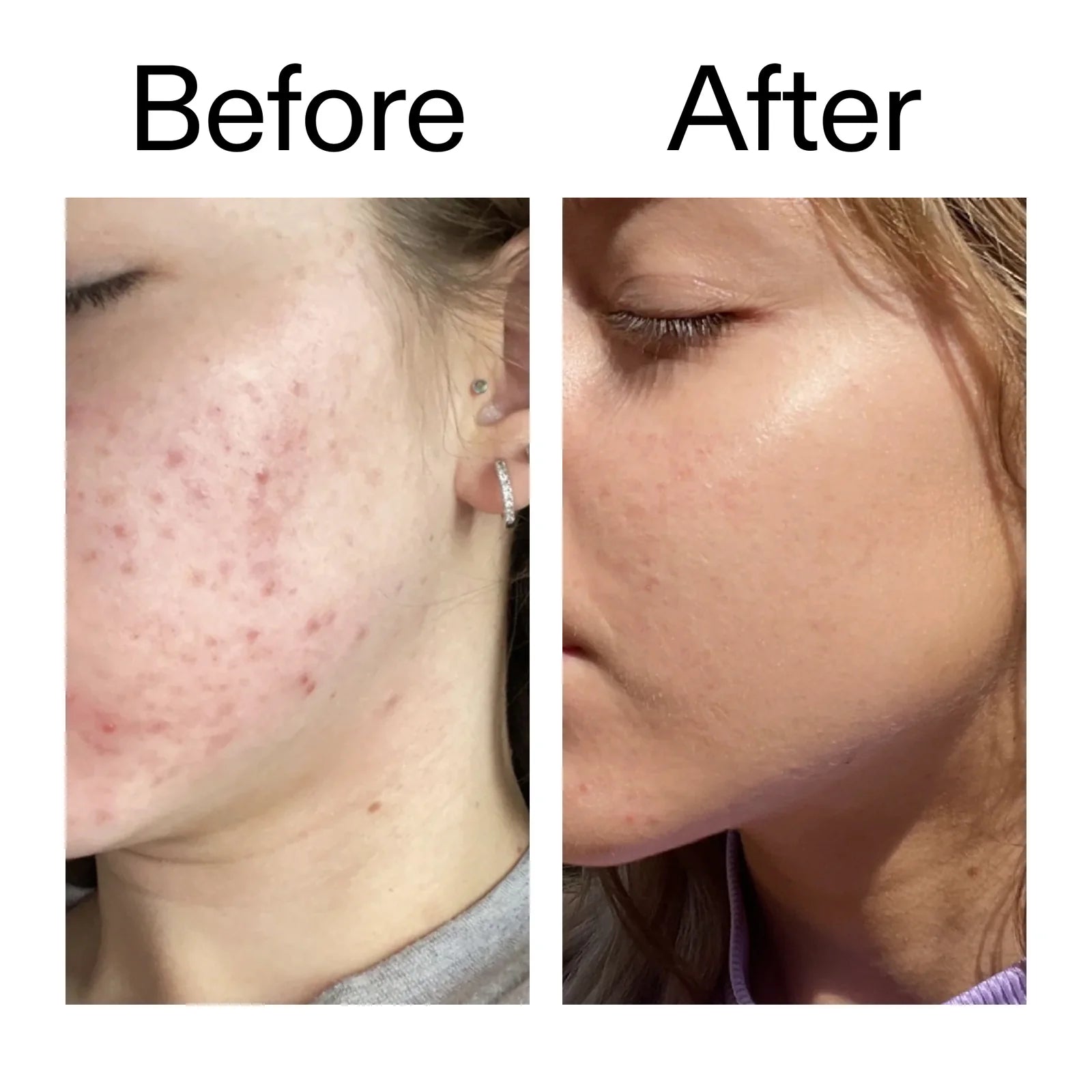 The Inkey list Niacinamide سيروم 30مل - الصورة 6