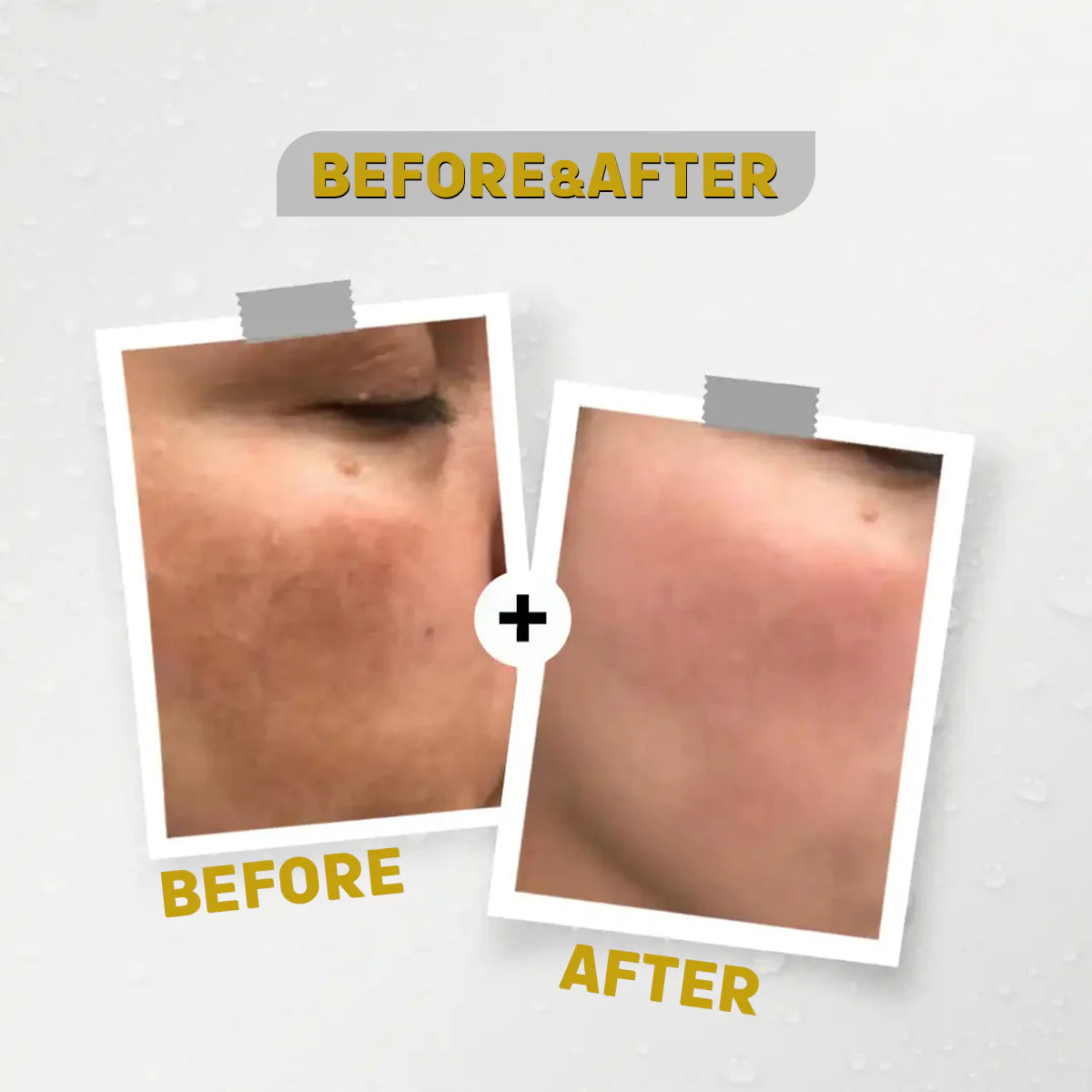 See Lit Skin سيروم 30 مل Professional - الصورة 5