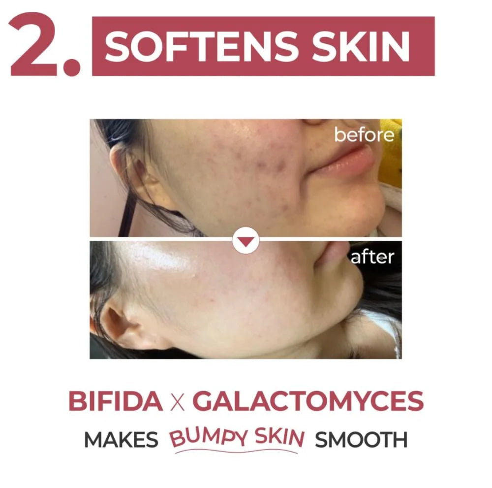 نامبوزين No. 3 Skin Softening سيروم - الصورة 6